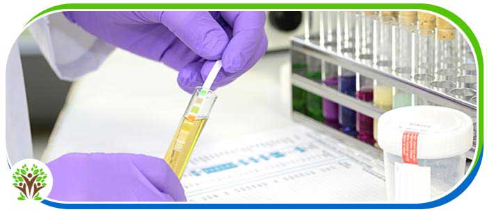 Urine Drug Screening Clinic Near Me in Palm Bay FL Urine Drug Screening Clinic Near Me in Palm Bay FL