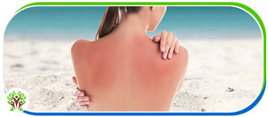 Sunburn Treatment Doctor Near Me in Palm Bay FL