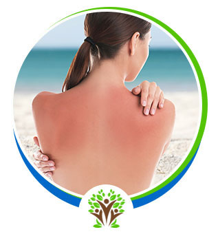 Sunburn Treatment Doctor Near Me in Palm Bay FL